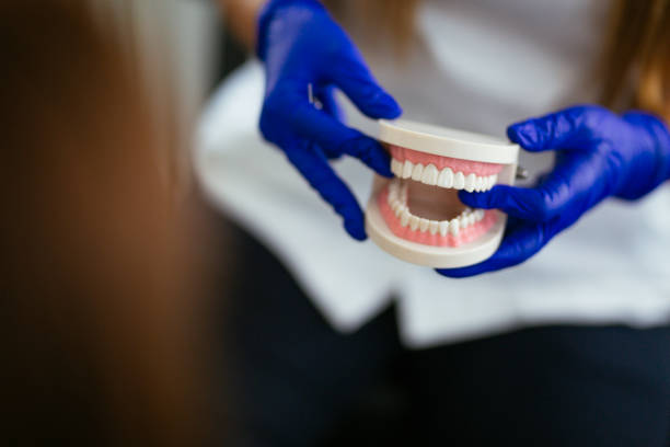 Dental Bonding in Carmel Valley Village, CA
